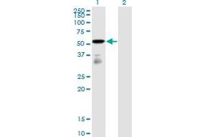 Western Blot analysis of FGFR1OP expression in transfected 293T cell line by FGFR1OP monoclonal antibody (M01), clone 2B1. (FGFR1OP antibody  (AA 1-379))