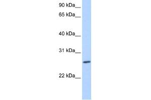 WB Suggested Anti-ZNF664 Antibody Titration:  0. (ZNF664 antibody  (N-Term))