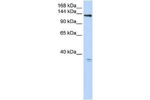 Human 293T; WB Suggested Anti-TMEM16C Antibody Titration: 0.