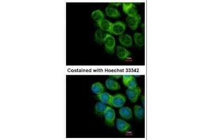 ICC/IF Image Immunofluorescence analysis of methanol-fixed A431, using PD-ECGF, antibody at 1:500 dilution. (Thymidine Phosphorylase antibody)