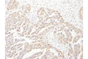 Immunohistochemistry (IHC) image for anti-Proteasome Subunit alpha 6 (PSMA6) (AA 196-246) antibody (ABIN7453443)