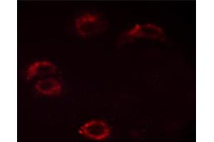 ABIN6267532 staining HUVEC cells by ICC/IF. (Crk antibody  (pTyr221))