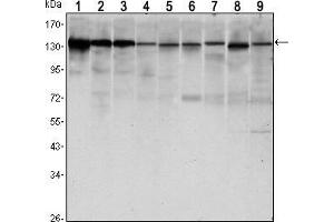 Western blot analysis using CDH1 mouse mAb against LNCAP (1),A431 (2), DU145 (3), PC-3 (4), MCF-7 (5), PC-12 (6), NIH/3T3 (7), C6 (8) and COS7 (9) cell lysate. (E-cadherin antibody)