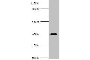 Western blot All lanes: DIMT1 antibody at 2 μg/mL + Mouse thymus tissue Secondary Goat polyclonal to rabbit IgG at 1/10000 dilution Predicted band size: 35 kDa Observed band size: 35 kDa