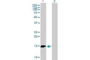 Western Blot analysis of BIRC5 expression in transfected 293T cell line by BIRC5 MaxPab polyclonal antibody. (Survivin antibody  (AA 1-142))