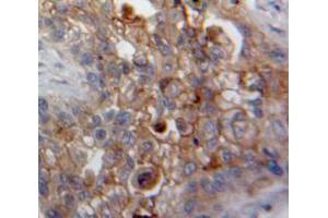 Used in DAB staining on fromalin fixed paraffin-embedded Lung tissue (DDR2 antibody  (AA 578-817))