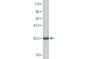 Western Blot detection against Immunogen (36. (CTNNB1 antibody  (AA 682-781))