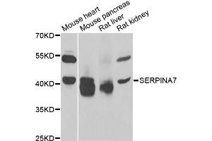 Western blot analysis of extracts of various cell lines, using SERPINA7 antibody (ABIN5975019) at 1/1000 dilution.
