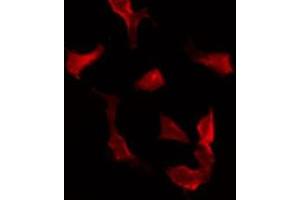 ABIN6275618 staining Hela by IF/ICC. (SYT16 antibody  (Internal Region))