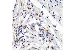 Immunohistochemistry of paraffin-embedded human normal colon using OAS1 antibody at dilution of 1:200 (400x lens). (OAS1 antibody)