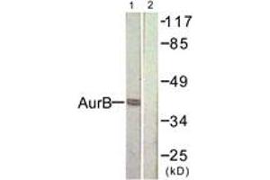 Western blot analysis of extracts from COS7 cells, treated with Nocodazole 1ug/ml 16h, using AurB (Ab-232) Antibody. (Aurora Kinase B antibody  (AA 198-247))