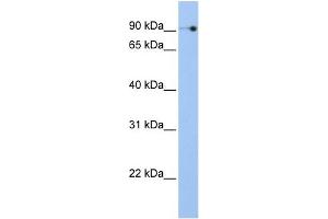 WB Suggested Anti-NOC3L Antibody Titration:  0. (NOC3L antibody  (N-Term))