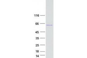 Validation with Western Blot (NCOA1 Protein (Transcript Variant 2) (Myc-DYKDDDDK Tag))