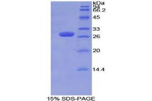 SDS-PAGE (SDS) image for Tubulin, delta 1 (TUBD1) (AA 236-455) protein (His tag) (ABIN2127114) (TUBD1 Protein (AA 236-455) (His tag))