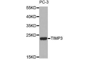 Western blot analysis of extracts of PC-3 cell lines, using TIMP3 antibody. (TIMP3 antibody  (AA 24-211))