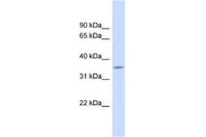 Image no. 1 for anti-Family with Sequence Similarity 26, Member F (FAM26F) (AA 143-192) antibody (ABIN6742019) (FAM26F antibody  (AA 143-192))