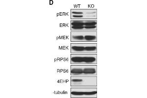 Depletion of 4EHP expression affects cell proliferation, survival, and ERK1/2 phosphorylation. (EIF4E2 antibody)