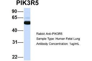 Host: Rabbit  Target Name: PIK3R5  Sample Tissue: Human Fetal Lung  Antibody Dilution: 1. (PIK3R5 antibody  (N-Term))