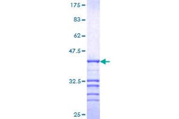 NCOR1 Protein (AA 2341-2440) (GST tag)