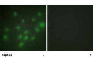 Immunofluorescence analysis of HUVEC cells, using HKR1 polyclonal antibody .