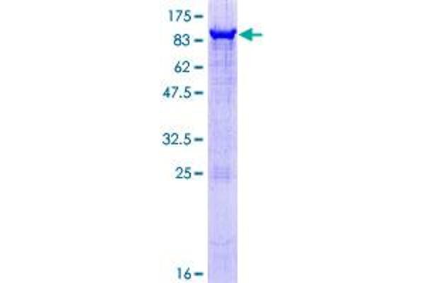 PAPSS2 Protein (AA 1-614) (GST tag)