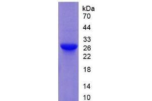 Image no. 1 for Glutathione S-Transferase mu 1 (GSTM1) (AA 1-218) (Active) protein (His tag) (ABIN6239877) (GSTM1 Protein (AA 1-218) (His tag))