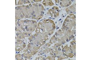 Immunohistochemistry of paraffin-embedded human stomach using TRPC3 antibody.