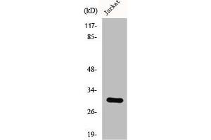 Western Blot analysis of LOVO cells using CSP Polyclonal Antibody (DNAJC5 antibody  (C-Term))