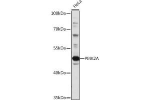 Western Blotting (WB) image for anti-Phosphatidylinositol 4-Kinase Type 2 alpha (PI4K2A) (AA 131-479) antibody (ABIN7269284)