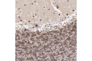 Immunohistochemical staining of human cerebellum with NCOR2 polyclonal antibody  shows strong moderate nuclear positivity in Purkinje cells, cells in molecular layer and cells in granular layer.