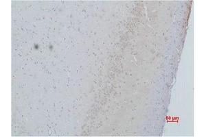Immunohistochemistry (IHC) analysis of paraffin-embedded Rat Brain Tissue using CACNG2 Polyclonal Antibody. (Stargazin antibody)