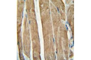 Immunohistochemistry analysis in formalin fixed and paraffin embedded human skeletal muscle reacted with PGAM2 Antibody (N-term) followed which was peroxidase conjugated to the secondary antibody and followed by DAB staining. (PGAM2 antibody  (N-Term))