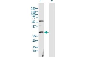 Western Blot analysis of CACYBP expression in transfected 293T cell line by CACYBP MaxPab polyclonal antibody. (CACYBP antibody  (AA 1-228))