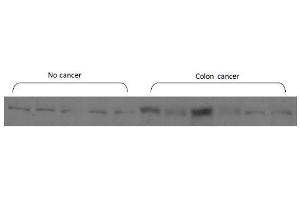 This image was kindly submitted by Kandy Velazquez from USC School of Medicine. (CD11b antibody  (AA 77-180))