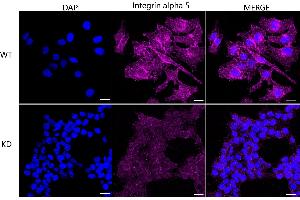 Immunocytochemical staining of HeLa cells using Integrin alpha 5 antibody (ABIN7799077), 1:1,000), Top panel: wild-type (WT), Bottom panal: Integrin alpha 5 shRNA knockdown (KD).