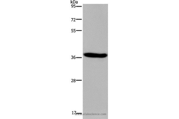 KCNK17 antibody