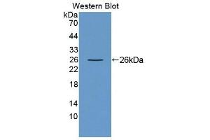Detection of Recombinant NIN, Rat using Polyclonal Antibody to Ninein (NIN) (Ninein antibody  (AA 1-153))