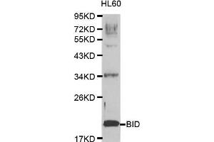 Western blot analysis of extracts of HL60 cell lines, using BID antibody. (BID antibody  (AA 1-130))