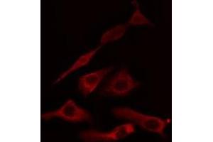 ABIN6275041 staining HuvEc cells by IF/ICC. (HSD11B1 antibody  (N-Term))