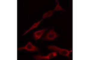 ABIN6275041 staining HuvEc cells by IF/ICC. (HSD11B1 antibody  (N-Term))
