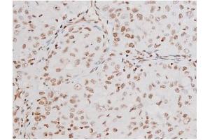 Immunohistochemistry (IHC) image for anti-Nuclear Factor-kB p65 (NFkBP65) (pThr435) antibody (ABIN6255688)