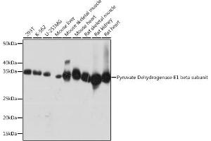 Western blot analysis of extracts of various cell lines, using Pyruvate Dehydrogenase E1 beta subunit Rabbit mAb (ABIN7269772) at 1:1000 dilution. (PDHB antibody)