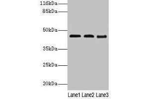 Western blot All lanes: BCAT2 antibody at 2 μg/mL Lane 1: NIH/3T3 whole cell lysate Lane 2: Mouse kidney tissue Lane 3: Mouse spleen tissue Secondary Goat polyclonal to rabbit IgG at 1/10000 dilution Predicted band size: 45, 34 kDa Observed band size: 45 kDa