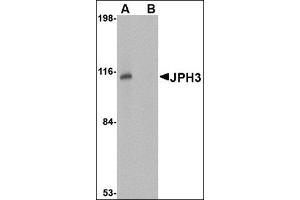 Western blot analysis of JPH3 in Daudi cell lysate with this product at 1 μg/ml in (A) the absence and (B) the presence of blocking peptide. (Junctophilin 3 antibody  (Center))