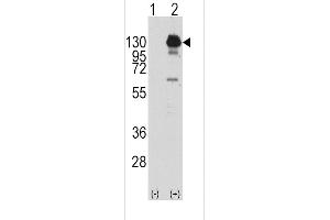 Western blot analysis of PDGFRA using rabbit polyclonal PDGFRA Antibody (Y762) using 293 cell lysates (2 ug/lane) either nontransfected (Lane 1) or transiently transfected with the PDGFRA gene (Lane 2). (PDGFRA antibody  (AA 740-769))