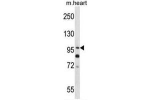 SULF2 Antibody (C-term) western blot analysis in mouse heart tissue lysates (35µg/lane). (SULF2 antibody  (C-Term))