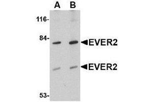 Western blot analysis of EVER2 in Jurkat cell lysate with AP30323PU-N EVER2 antibody at (A) 1 and (B) 2 μg/ml. (TMC8 antibody  (Center))