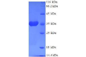 SDS-PAGE (SDS) image for ADP-Ribosylation Factor 6 (ARF6) (AA 1-175), (full length) protein (His-SUMO Tag) (ABIN4975658)