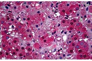 Human Adrenal Cortex: Formalin-Fixed, Paraffin-Embedded (FFPE) (ABCB1 antibody  (Extracellular))