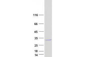 Chromosome 4 Open Reading Frame 33 (C4orf33) (Transcript Variant 2) protein (Myc-DYKDDDDK Tag)